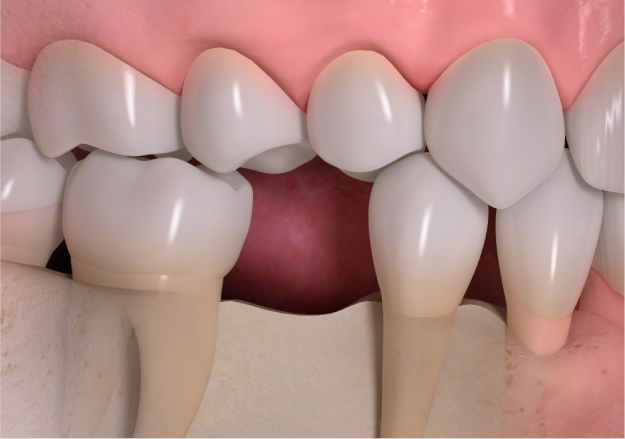 正常な歯並び